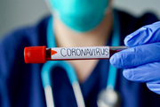 هیچ موردی از کروناویروس در سیستان و بلوچستان مشاهده نشده است