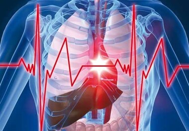 مقایسه علایم و نشانه های سکته قلبی و مغزی